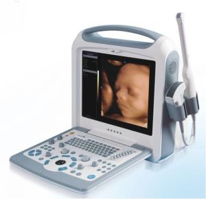 Machine à ultrasons Doppler couleur ， Présentation du produit